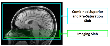 Sagittal view of a brain MRI with a green box showing the imaging slab and an aqua box showing the combined superior and pre-saturation slab