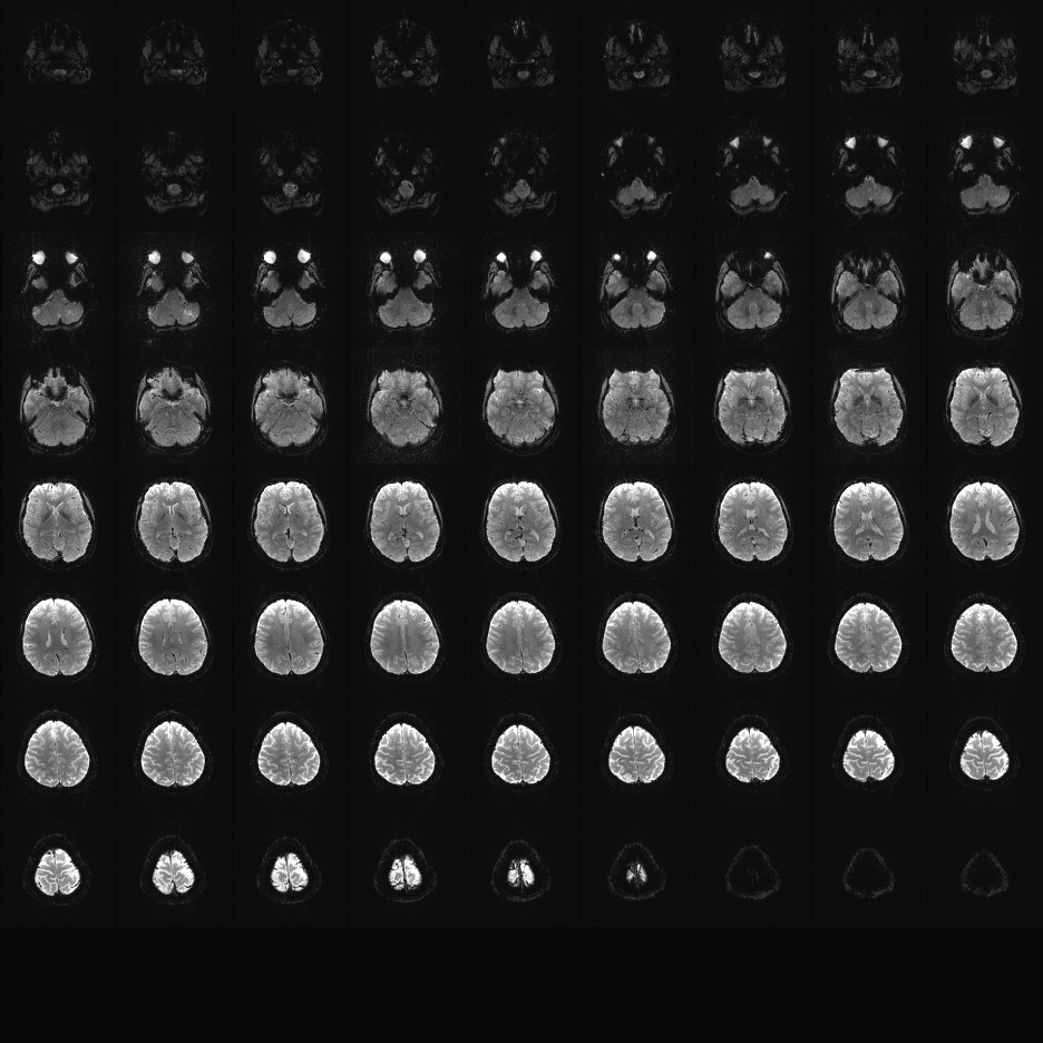 2mm MB2 IPAT2 TR2pt5se.