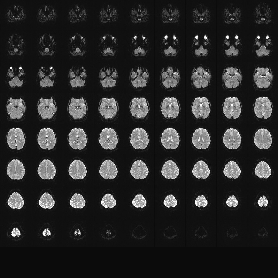 2mm MB2 TR3pt1sec 12c.