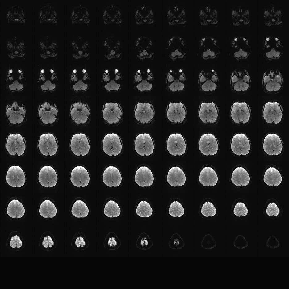 2mm MB3 IPAT2 TR1pt7se.
