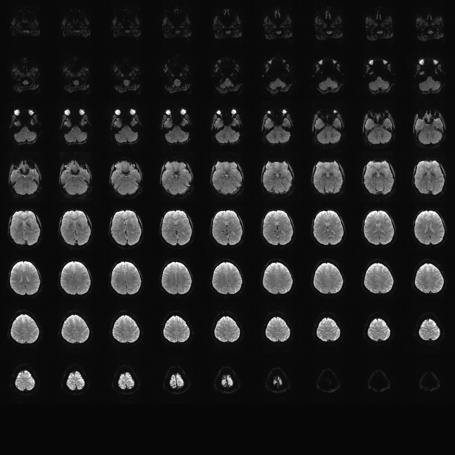 2mm MB4 IPAT2 TR1pt3se.
