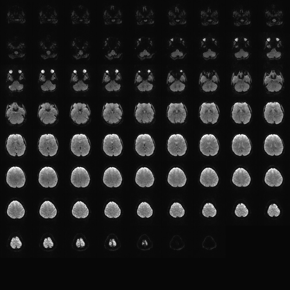 2mm MB5 IPAT2 TR955mse.
