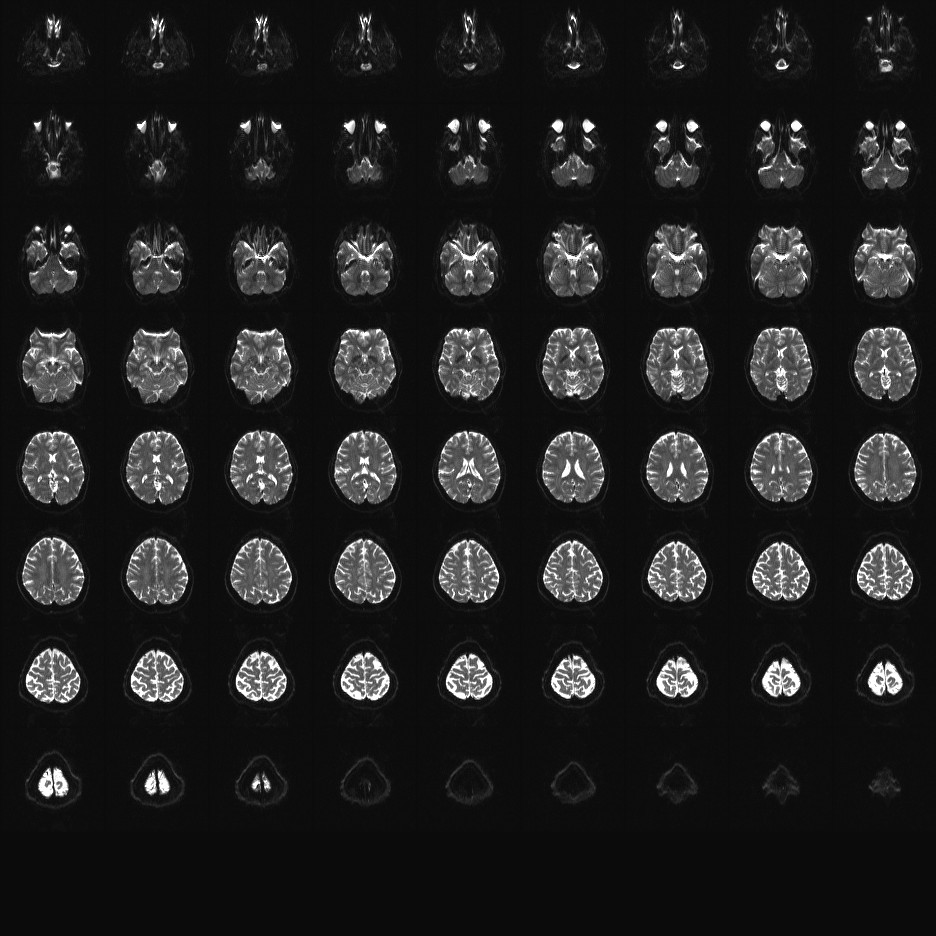 2mm diffusion MB2 12c.