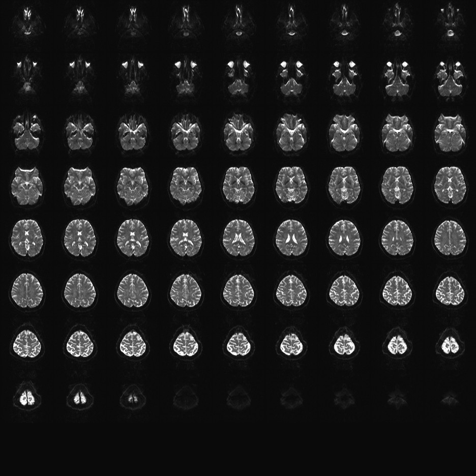 2mm diffusion MB3 12c.